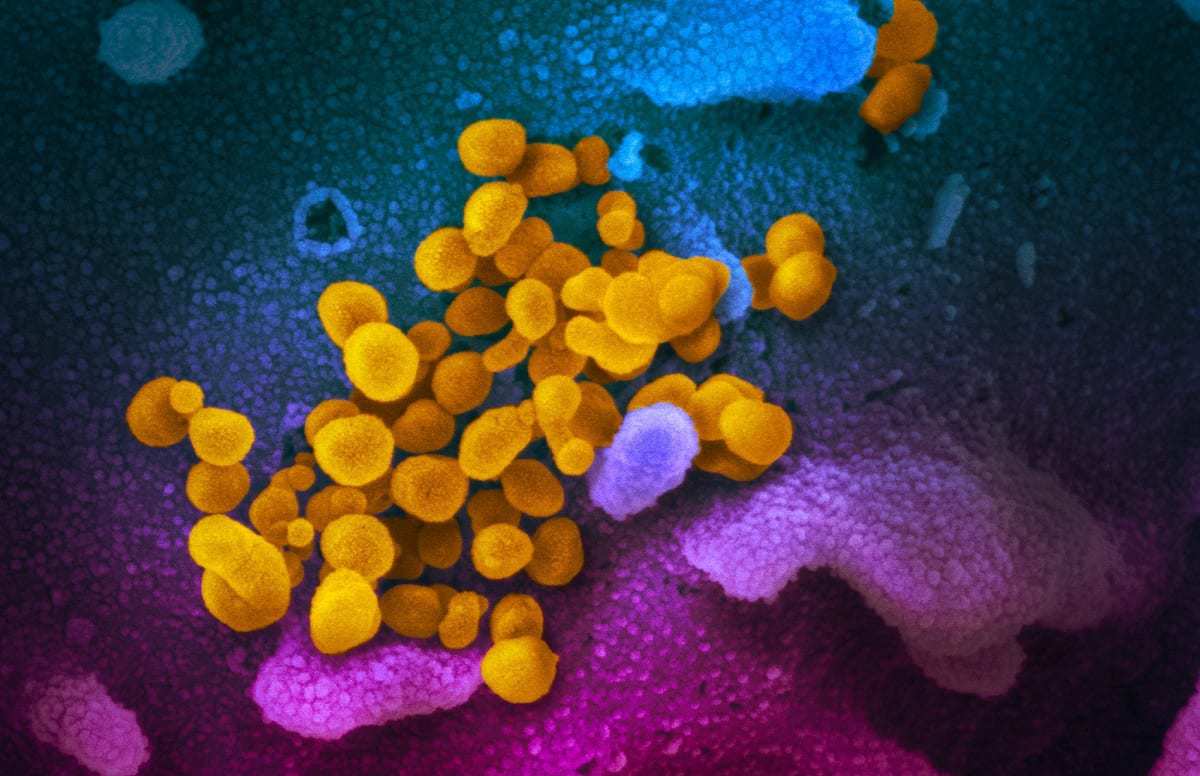 Novel Coronavirus SARS-CoV-2