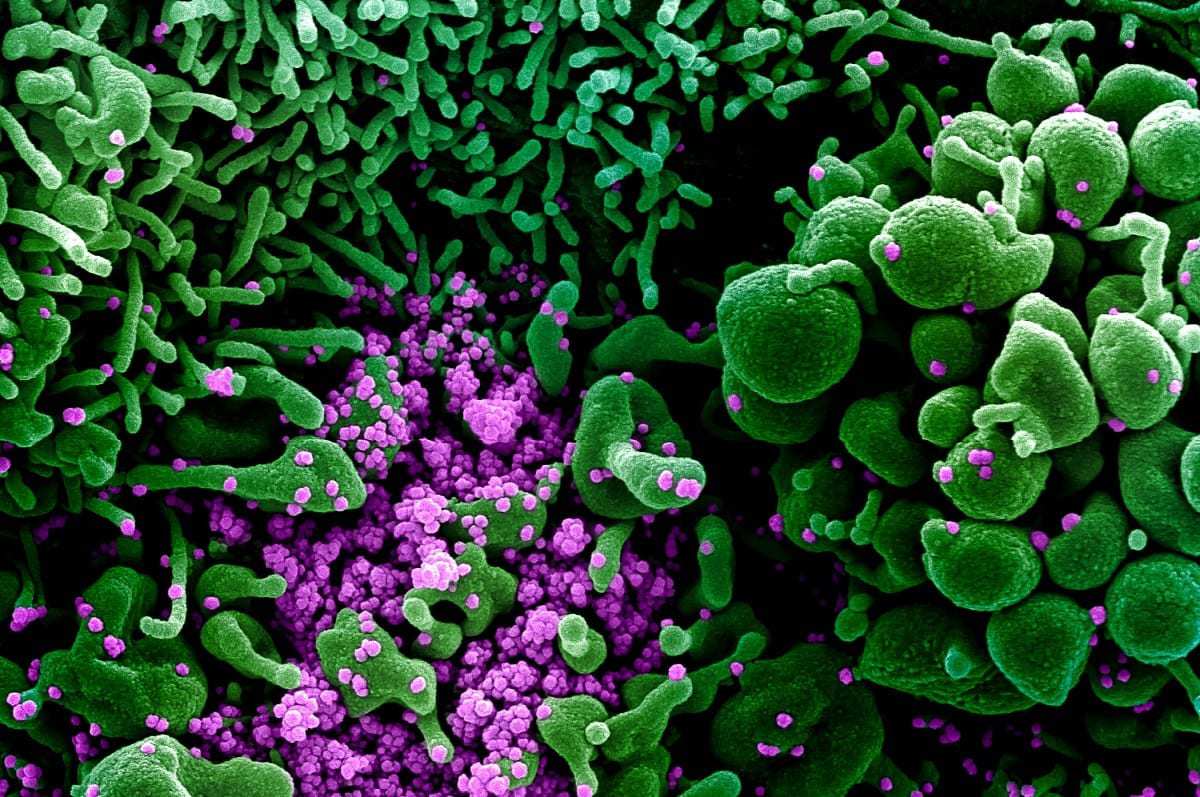 Novel Coronavirus SARS