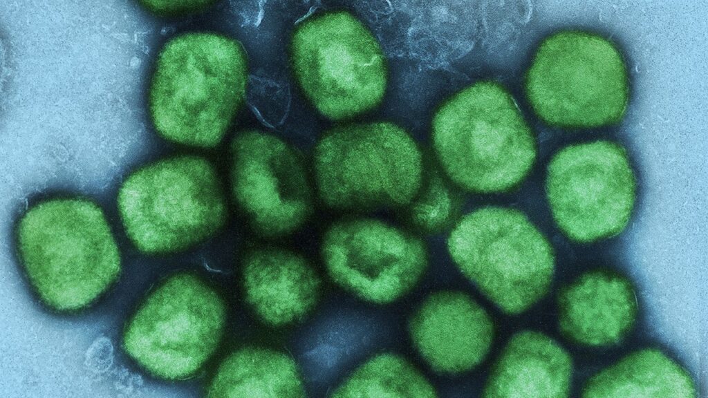 Monkeypox Cases in U.S. Military Climbs Tenfold in Less than 4 Weeks